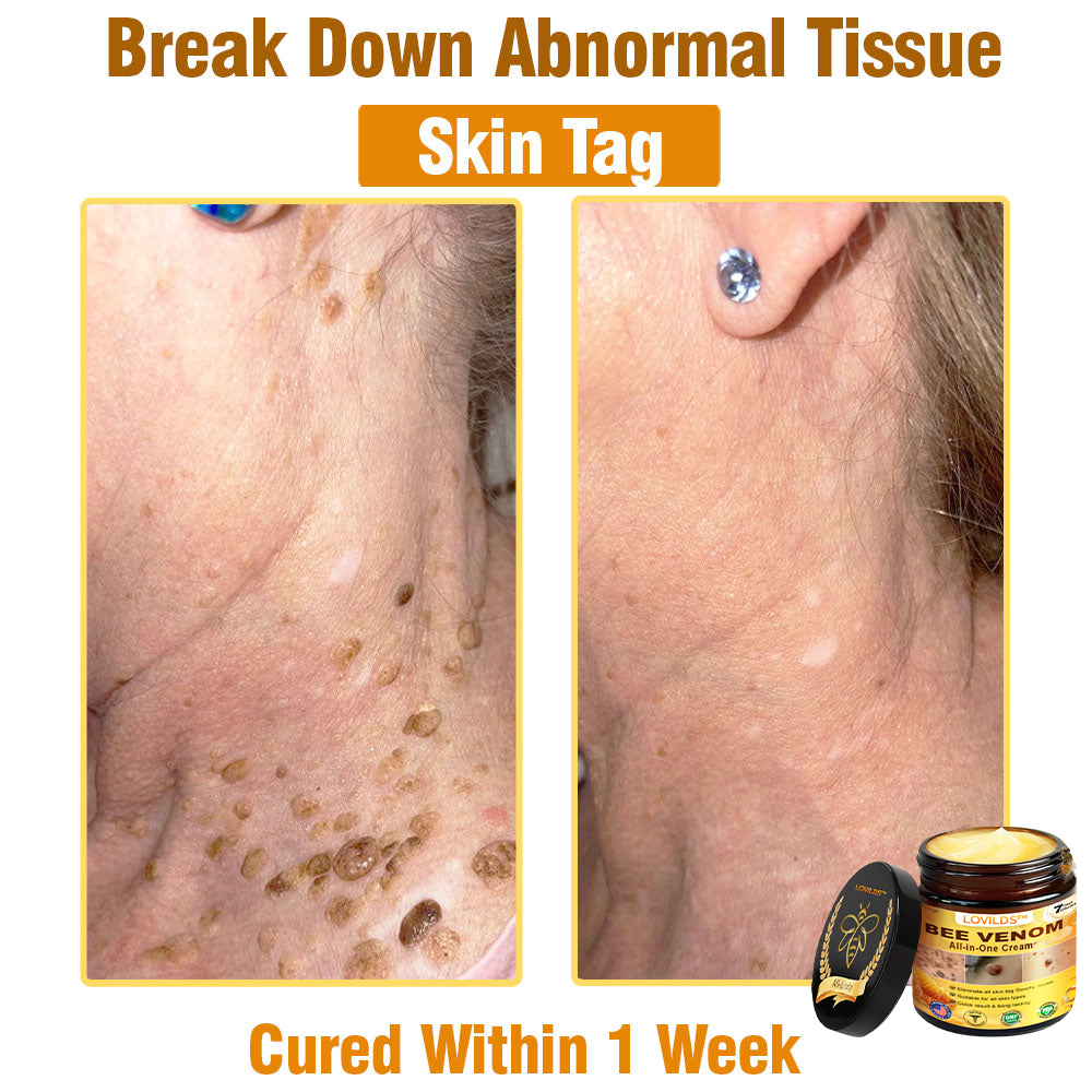 LOVILDS™ Bee Venom Cream – 🌸 Anti-Aging, Hydrating & Skin Repair